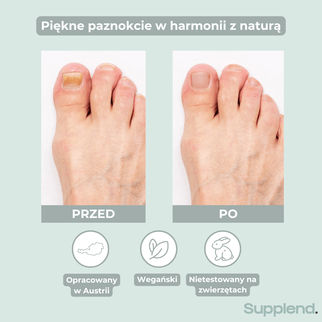 Długopis do paznokci (Magazyn Zdrowie co Tydzień)