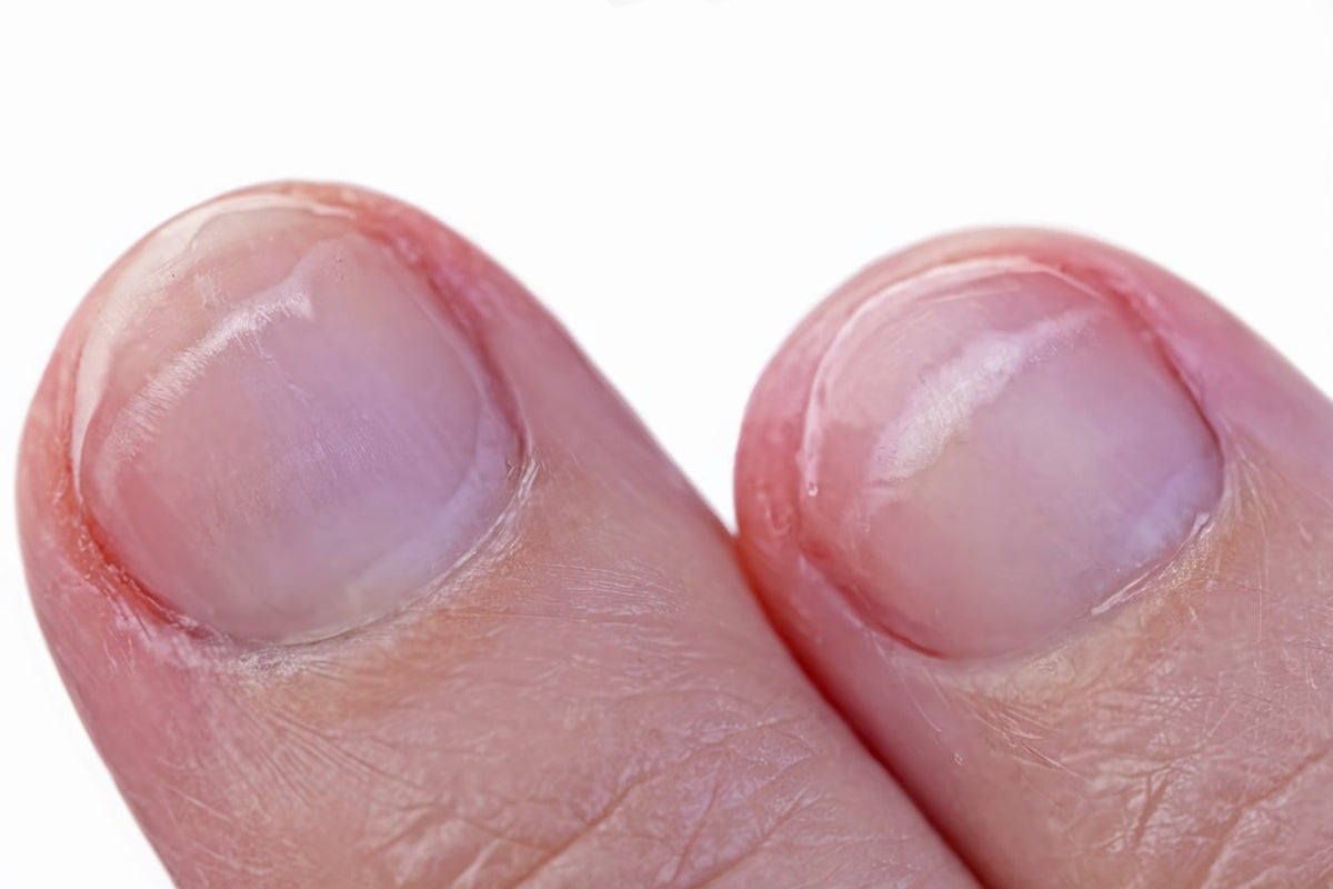 https://supplend-global.com/cdn/shop/files/white_spots_on_nails.jpg?v=1741693808&width=3840